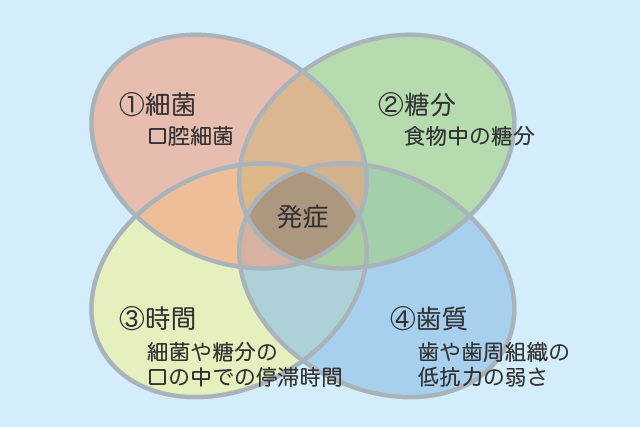 むし歯の4大発症要因